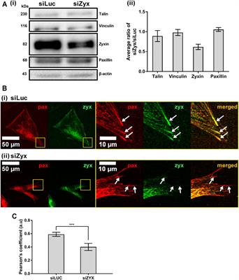 Zyxin Is Involved in Fibroblast Rigidity Sensing and Durotaxis